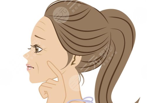 動(dòng)態(tài)紋和靜態(tài)紋哪個(gè)屬于真性皺紋？