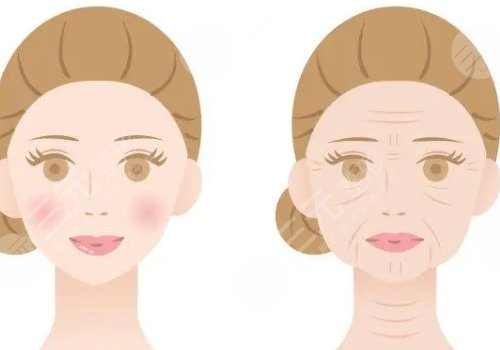 動(dòng)態(tài)紋和靜態(tài)紋哪個(gè)屬于真性皺紋？