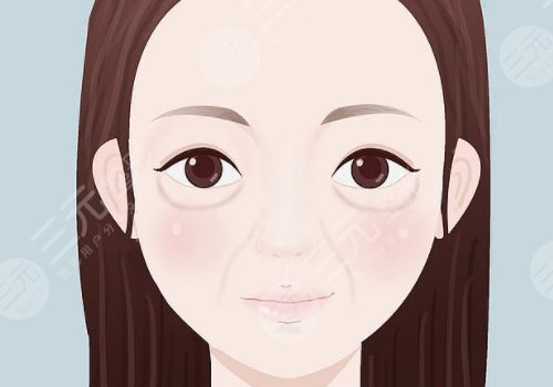 動(dòng)態(tài)紋和靜態(tài)紋哪個(gè)屬于真性皺紋？