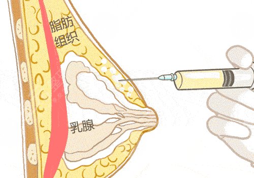 廣州市荔灣區(qū)人民醫(yī)院整形美容科怎么樣？