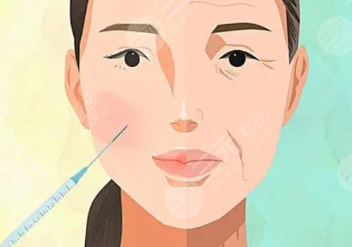 薇旖美可以注射眼部周圍的皺紋不？