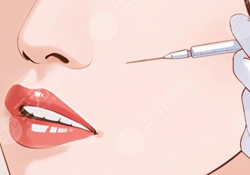 薇旖美可以注射眼部周圍的皺紋不？