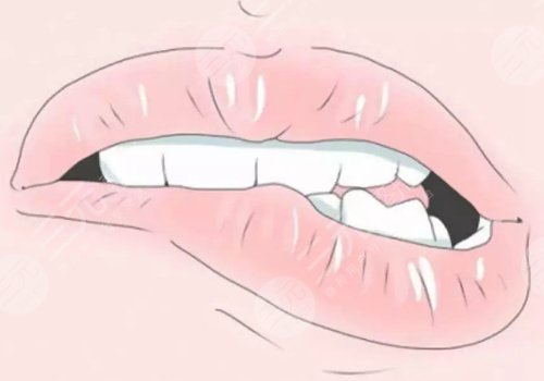 唇部老化的表現(xiàn)有哪些？改良方法有這些！