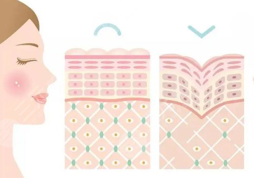 雙美膠原蛋白有幾種型號(hào)？