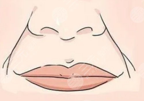 括號紋怎么去掉？怎么形成的？改良方式解讀！