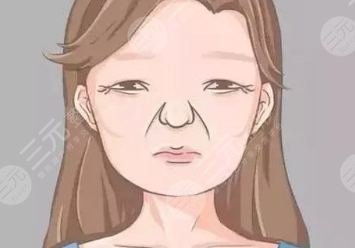 括號紋怎么去掉？怎么形成的？改良方式解讀！