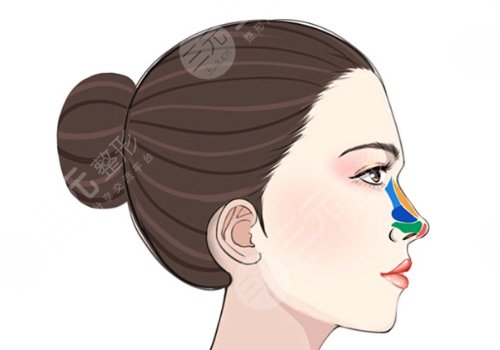 廣州市荔灣區(qū)人民醫(yī)院整形美容隆鼻怎么樣？