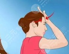 水剝離拉皮手術(shù)可以維持多久？一般3-5年，具體維持效果因人而異！