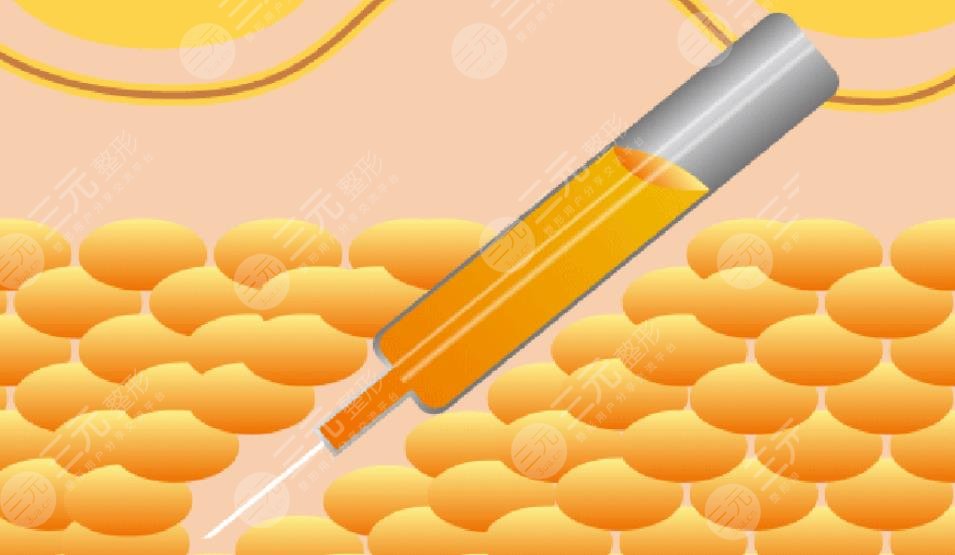 謝宏彬醫(yī)生擅長項目