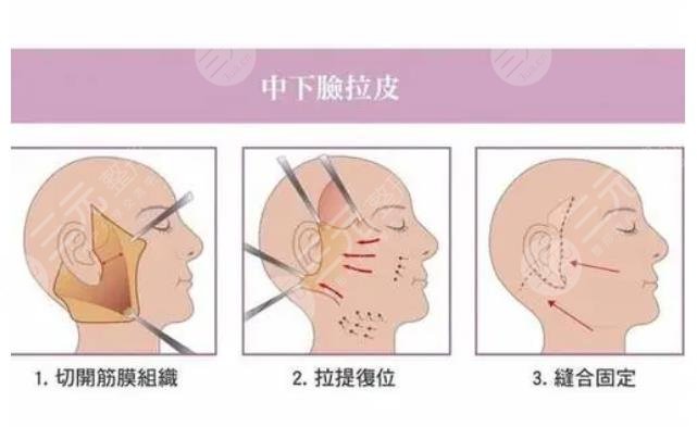 蕭志波醫(yī)生擅長項(xiàng)目