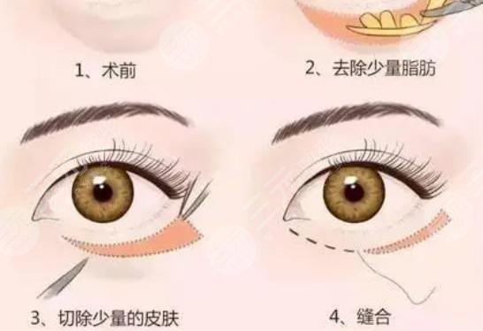 蕭志波醫(yī)生擅長項(xiàng)目