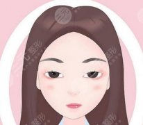 眼周小拉皮是怎么樣做的？操作基本信息解答、六大注意事項(xiàng)科普！