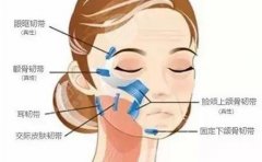 顳部懸吊拉皮是怎么樣做的？原理簡(jiǎn)介，術(shù)后注意事項(xiàng)要了解！