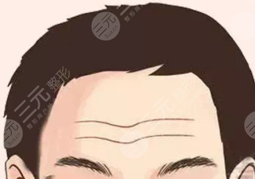 抬頭紋怎么去除有效男生？