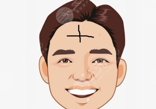 抬頭紋怎么去除有效男生？