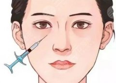 濡白天使適合打淚溝嗎？眼部條件合適就可以使用哦、相關(guān)知識科普