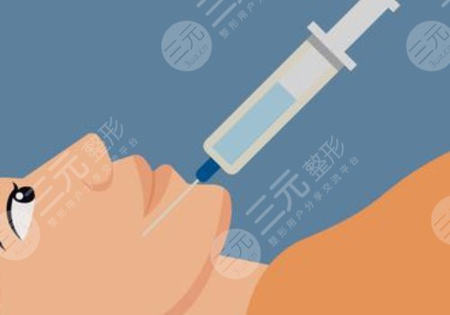 玻尿酸填充下巴有什么副作用？