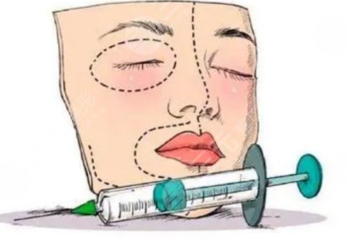 玻尿酸填充下巴有什么副作用？