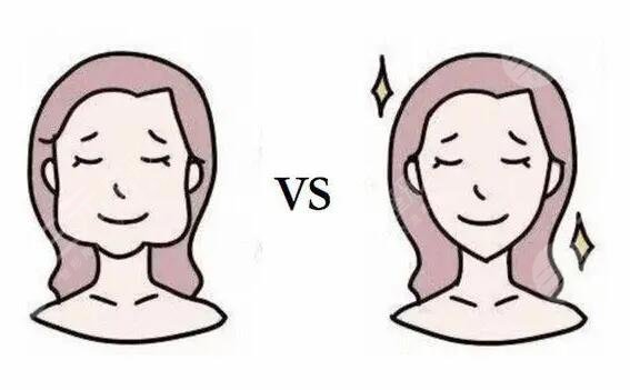 誰(shuí)適合輪廓固定術(shù)?