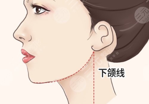 下頜線提升前后對(duì)比圖