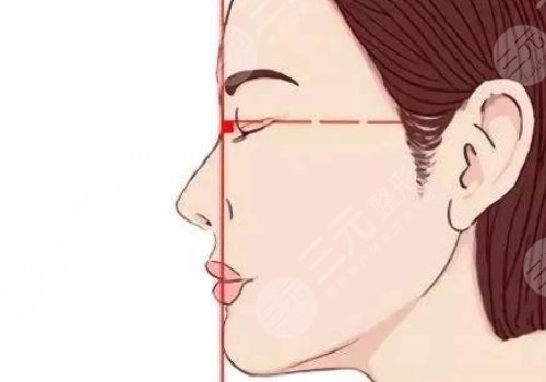 下頜線提升前后對(duì)比圖