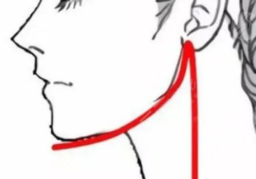 下頜線提升前后對(duì)比圖