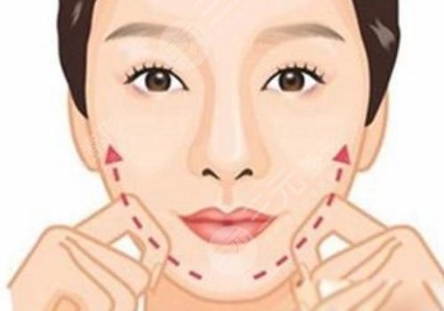 下頜線提升前后對(duì)比圖