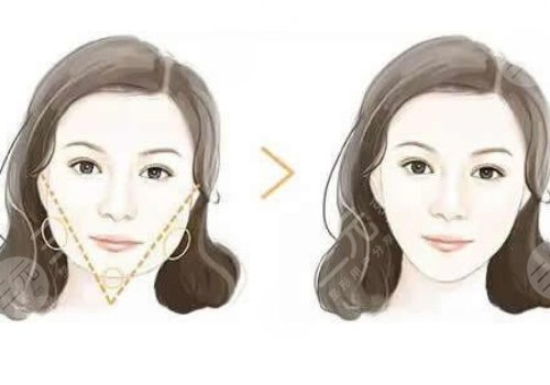 深圳美萊張華彬和黃海龍誰技術(shù)好？