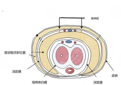 玻尿酸男性增大注射要多少錢(qián)？