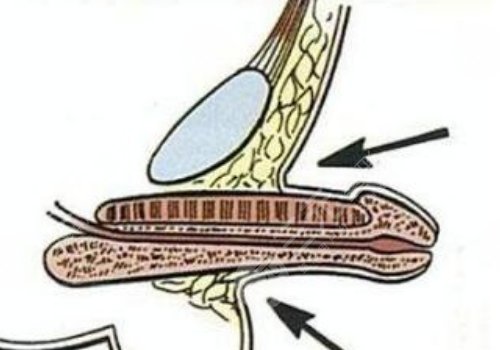 玻尿酸男性增大注射要多少錢(qián)？