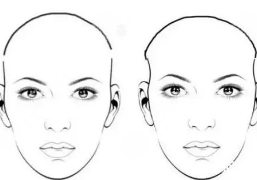 假體填充太陽凹大概多少錢？