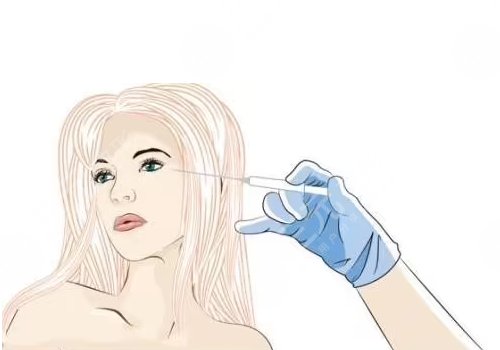 玻尿酸填充太陽凹大概多少錢？