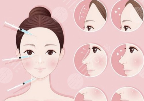 玻尿酸輪廓固定提升能保持多久呢？