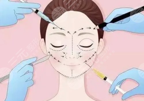 玻尿酸輪廓固定提升能保持多久呢？