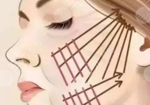 面部提升術(shù)的危害有什么？