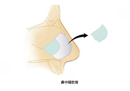 靳玉彪做的鼻子怎么樣？