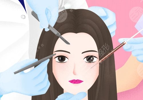 輪廓針哪一種牌子好