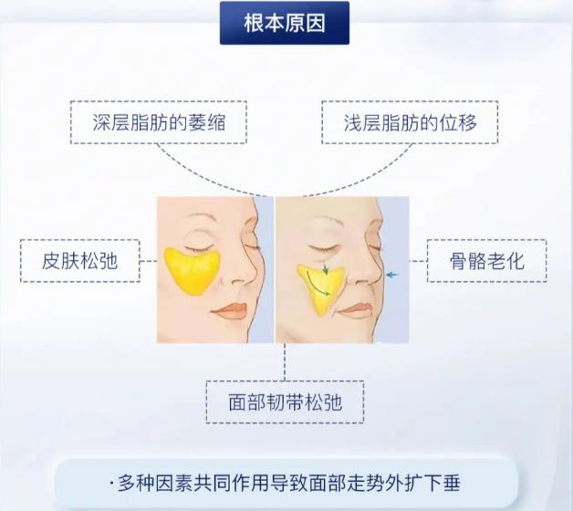 醫(yī)美輪廓固定做什么項目好？科普分享，抗衰新潮流！