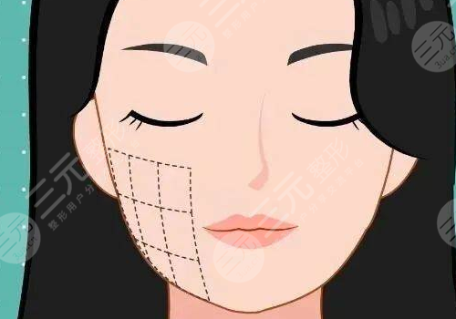 下頜提升針幾天有效果？