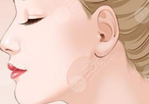 下頜提升針幾天有效果