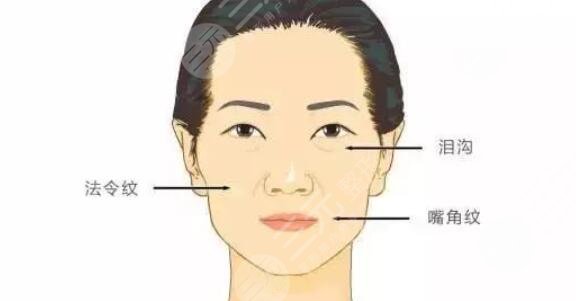 內(nèi)輪廓固定外輪廓固定