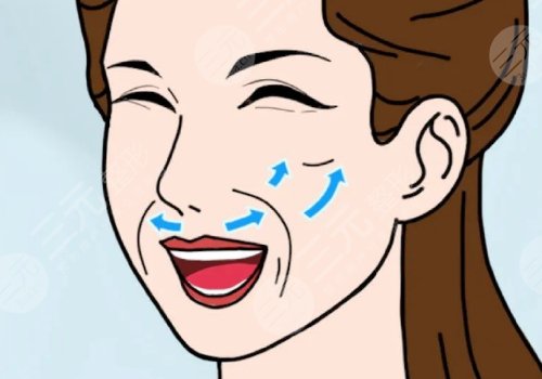 臉部提拉緊致手術(shù)多少錢？手術(shù)方式有哪些？多久能恢復(fù)？