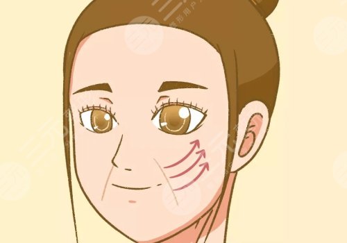 小拉皮手術(shù)好處和壞處有哪些？