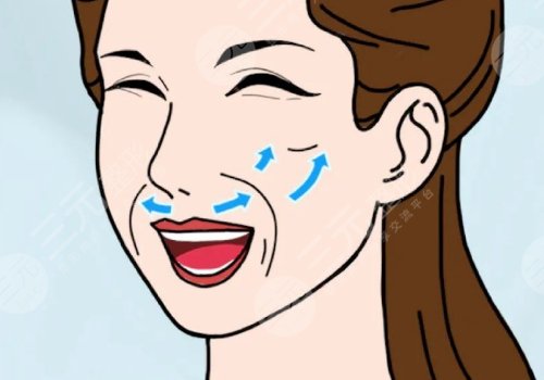 小拉皮手術(shù)好處和壞處有哪些？