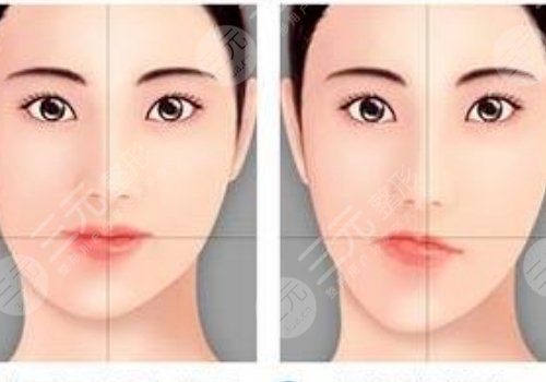 嘴巴歪整形大概多少錢？