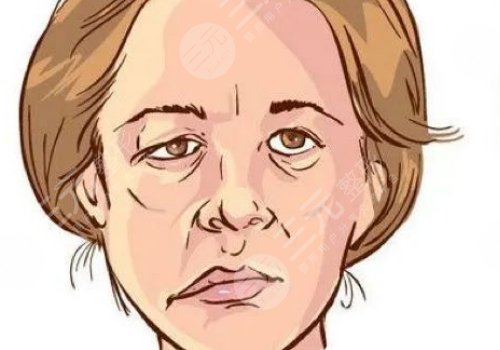 嘴巴歪整形大概多少錢？