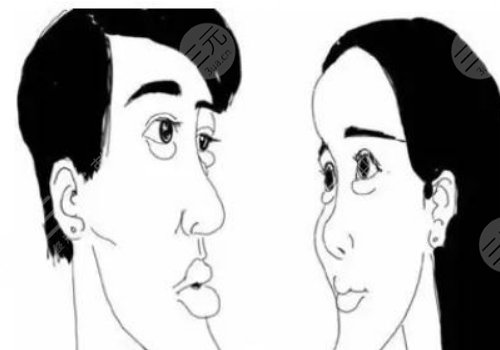 月亮臉矯正手術(shù)多少錢？