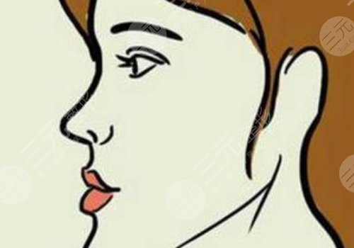 月亮臉矯正手術(shù)多少錢？