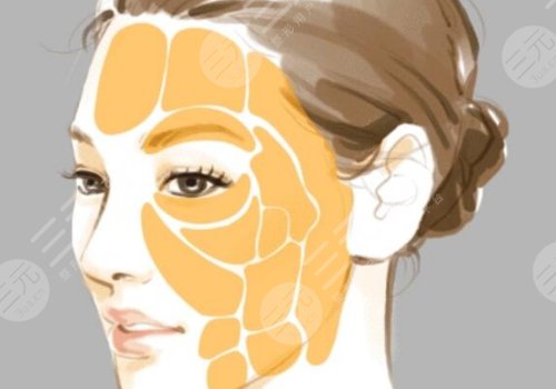 凹陷修復(fù)多少錢一個(gè)坑？