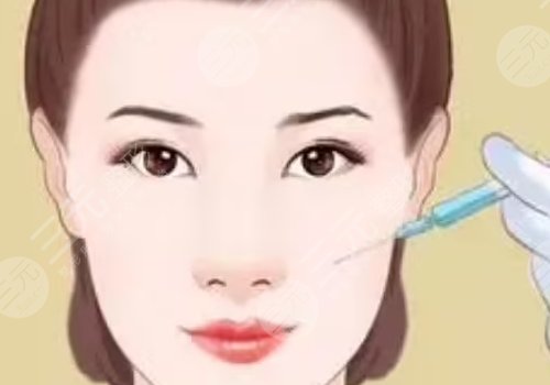 緊致提升針能保持多久？